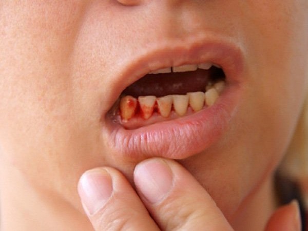 Nằm mơ thấy máu trong miệng